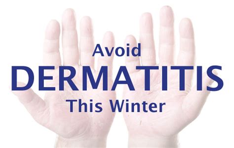 Get 42 Eczema Winter Rash On Hands