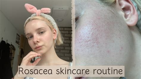 Rosacea Skin Care Routine I The Ordinary And Korean Skincare Youtube
