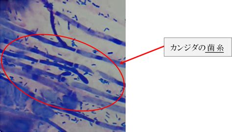 コロナ かゆみ 症状 | 体のあちこちが【かゆい】のはなぜ ...