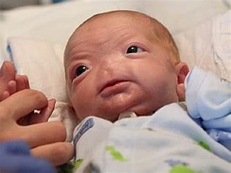 Facebook Bans Picture Of Baby Born Without A Nose Calls It Shocking