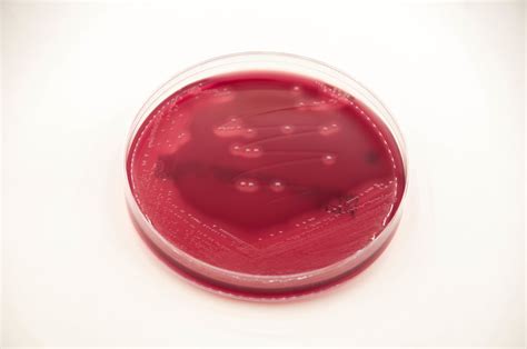 Phenylethyl Alcohol Blood Agar Pea Anaerobe Systems