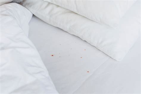 Doktrin Görünüm Martin Luther King Küçük Black Spots On Sheets Not Bed Bugs Püre Daire çevresi Sürü