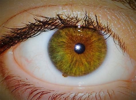 Central Heterochromia Or Just Hazel Now With Fuck Yeah