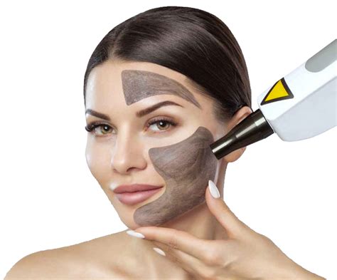 Carbon Laser Peeling Skintastics Cosmetische Kliniek