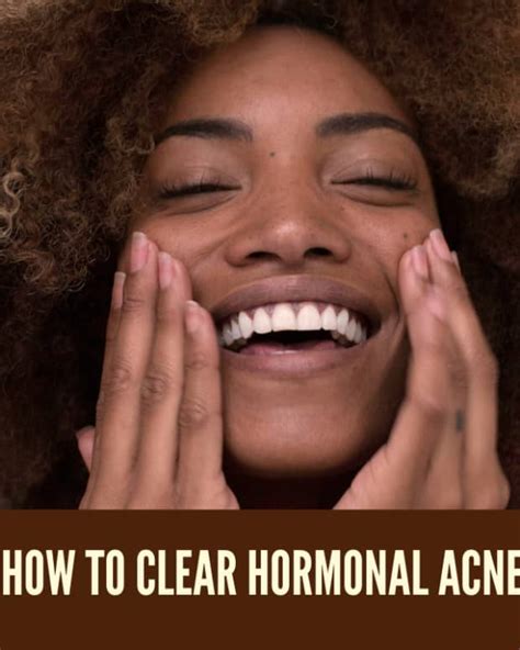 How To Clear Up Acne With Homemade Remedies And Effective Treatments
