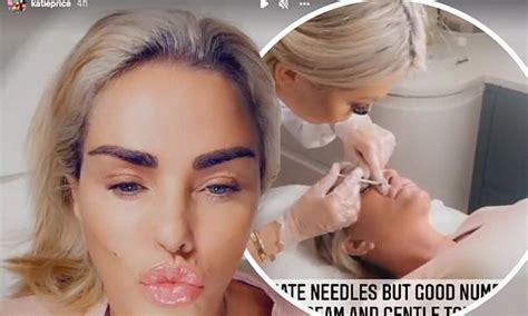 Katie Price Shows Off Her Plump Pout After Getting Lip Filler