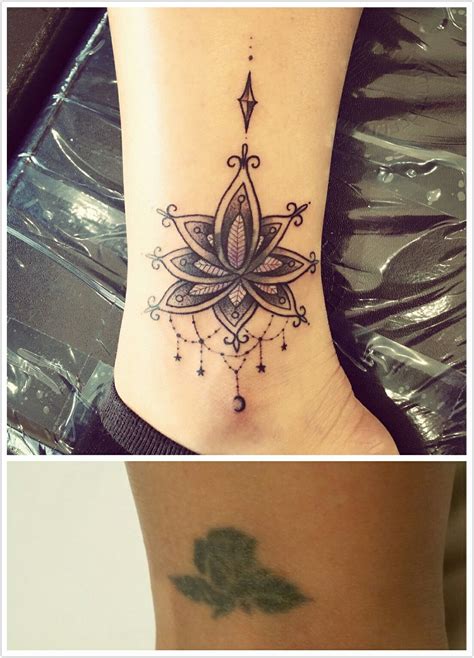 Tattoo Cover Up Before And After Lotus Tattoo Flower Tattoo For Girl