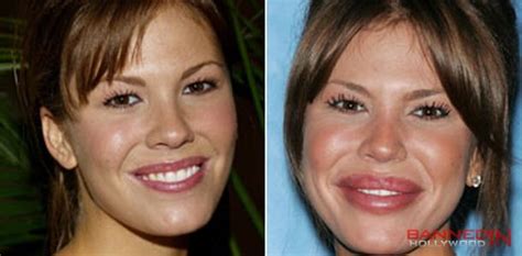 50 Celebrities Then And Now Banned In Hollywood Celebrity Plastic