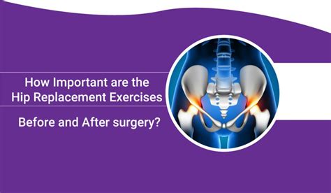 Importance Of Hip Replacement Exercises Before And After Surgery