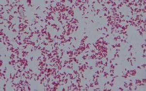 How does cascade do it? Gram negative, pink colored, small rod shape E. coli under ...