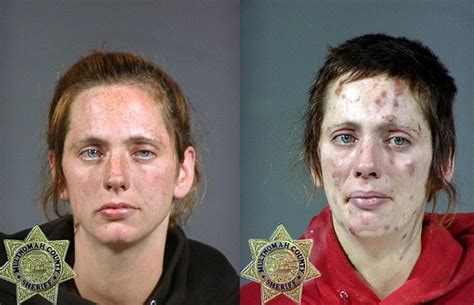 From Drugs To Mugs Shocking Before And After Images Show The Cost Of