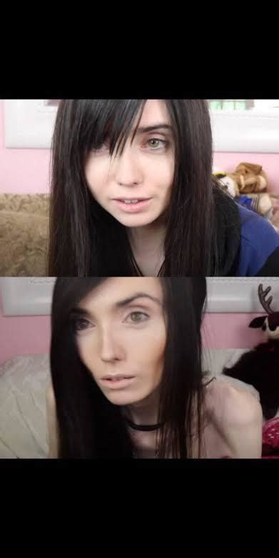 This Is Eugenia Cooney A Youtuber And Twitch Streamer Who Suffers From Anorexia Top Image Is