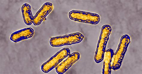What Is Listeria Facts You Need To Know