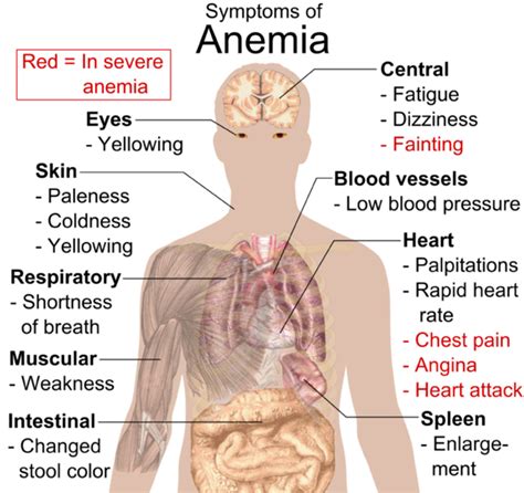 the signs and symptoms of anemia youmemindbody