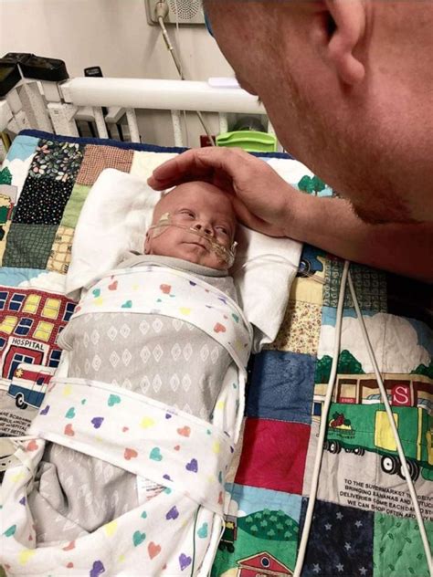 Remarkable Recovery 1 Pound Preemie Triumphs In Nicu And Finally Heads