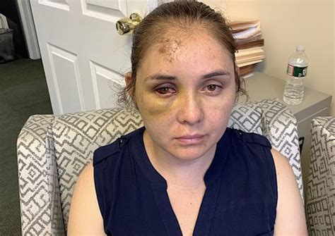 N J Mom Beaten Unconscious By Babe Bully Who Threatened Her Son In Hate Crime Lawyer Says