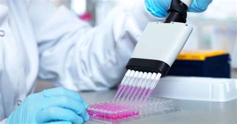 Astrazeneca's new clinical trial results are positive but confusing, leaving many experts a volunteer participating in the astrazeneca vaccine trial having blood drawn in oxford, england, last week.credit. Coronavirus. 400 milioni di dosi del vaccino di Oxford pronte a settembre