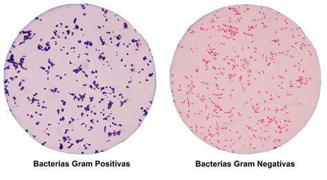Diferencia Entre Una Bacteria Gram Positiva Y Una Gram Negativa Amoci