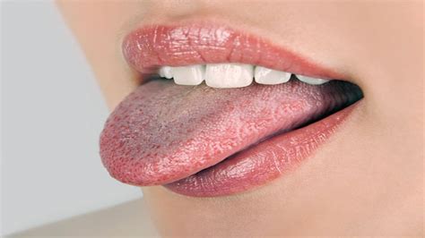 Black Spots On Tongue Causes Prevention Tips And Home