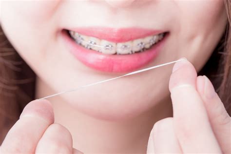 Dengan kedudukan gigi yang baik akan membantu untuk memudah proses pengunyahan makanan yang boleh mempengaruhi fungsi penghadaman. Cara Menggunakan Benang Gigi untuk Pemakai Behel | HonestDocs
