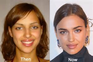 Compare her height, weight, eyes, hair color, shoe size, body measurements with other celebs. Irina Shayk Plastic Surgery Before and After Photos