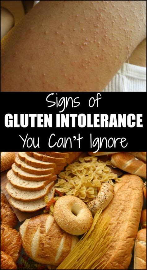 Signs Of Gluten Intolerance You Cant Ignore Signs Of Gluten