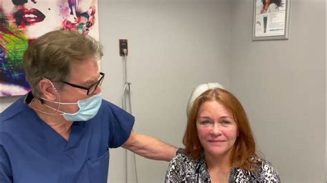 Facelift Patient 8 Day Post Surgery Visit With Dr Steven Hopping