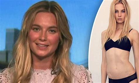 Victoria S Secret S Bridget Malcolm Suffers From Body Dysmorphia Daily Mail Online