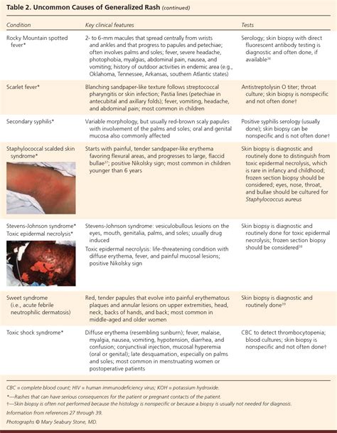 table 2 from the generalized rash part i differential diagnosis semantic scholar
