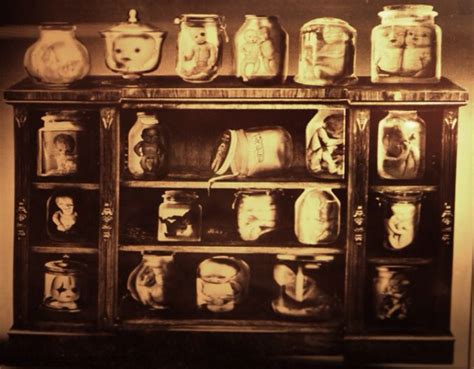 Old Photo Of Fetal Specimens From The Mutter Museum In Philadelphia