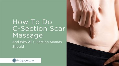 C Section Scar Massage For Core Healing Brb Yoga
