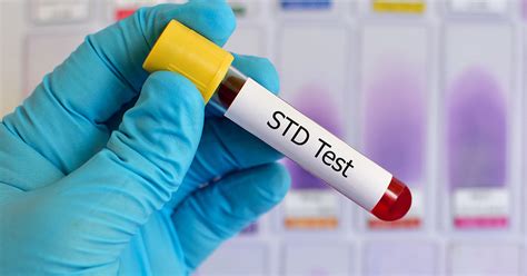 Cdc Report Says Gonorrhea Chlamydia Syphilis Cases Rise To All Time