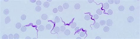 Cdc African Trypanosomiasis