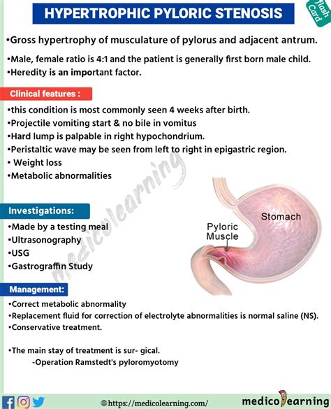 Hypertrophic Pyloric Stenosis Medicolearning
