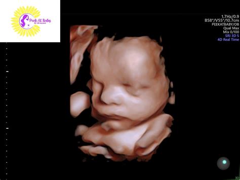 The Differences Between 2d 3d And 4d Ultrasounds