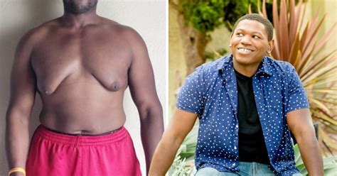 Man Who Avoided Dating Because Of His Moobs Has Them Surgically