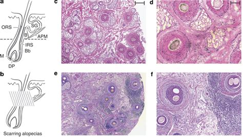 Histology Of Normal And Lpp Scalp Tissue A Structure Of The Human