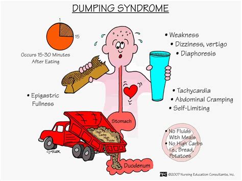 Dumping Syndrome New