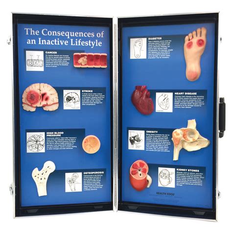 Effects Of An Inactive Lifestyle 3 D Display Health Edco