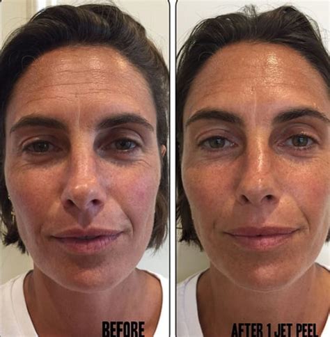 Sa biographie, son actualité, ses photos et vidéos. Alessandra Sublet : les résultats de son soin anti-âge