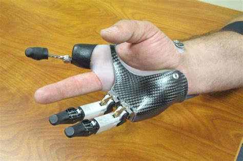 Finger And Partial Hand Prosthetic Options Prosthetics Blog