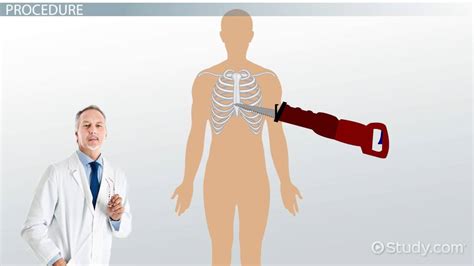 Autopsy Definition Types And Procedure Lesson