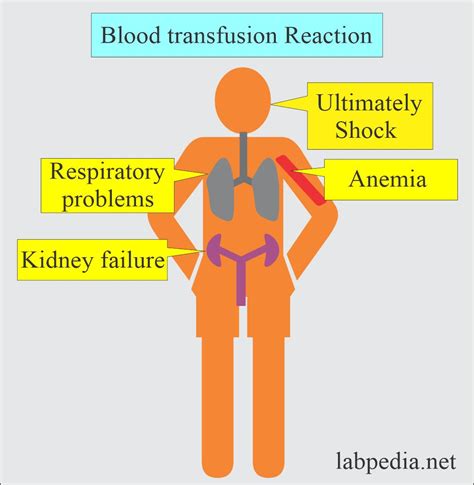 Blood Transfusion Reactions Updated May By Kamlesh Kumar