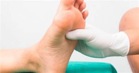 Nuevo apósito mejora curación de úlceras del pie diabético