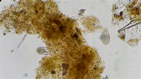 Maybe you would like to learn more about one of these? Full HD. Motion Of Single-celled Animals (infusoria) Under ...