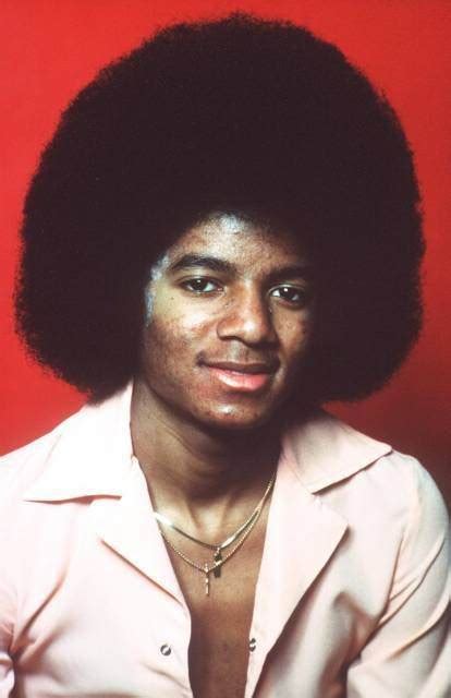Why Did Michael Jacksons Skin Turn White Quora