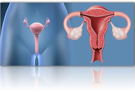 Colo Do Utero Anatomia