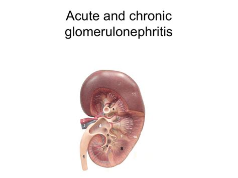 14 Acute And Chronic Glomerulonephritis