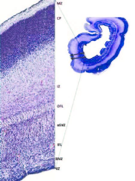 Germinal Zones In The Occipital Lobe Of Human Fetal Telencephalon At 17