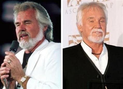 Rogers says that photography was once his obsession, before it morphed into a passion. Chatter Busy: Kenny Rogers Plastic Surgery